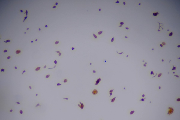 物聯(lián)網(wǎng)孢子捕捉儀圖片2